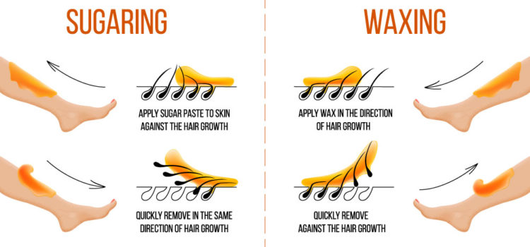 Sugaring Hair Removal sugaring-hair-removal
